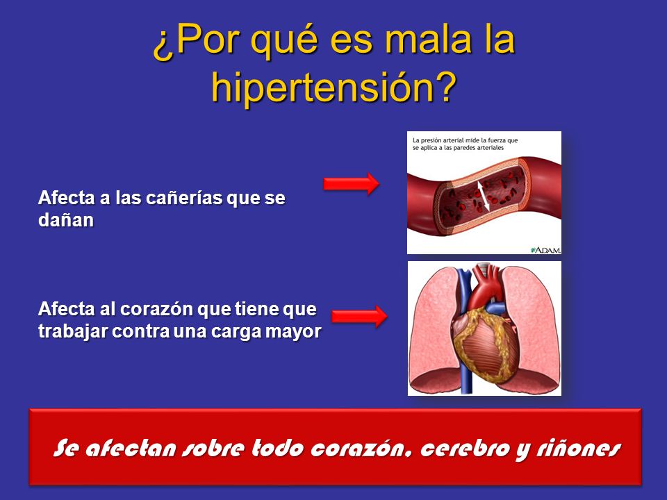 Q consecuencias trae la presion alta